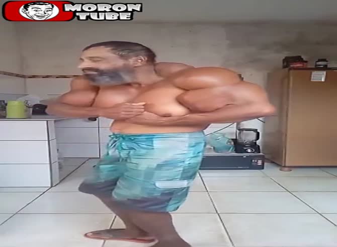 Video :The bodybuilder who famously injected himself with synthol has recently passed away